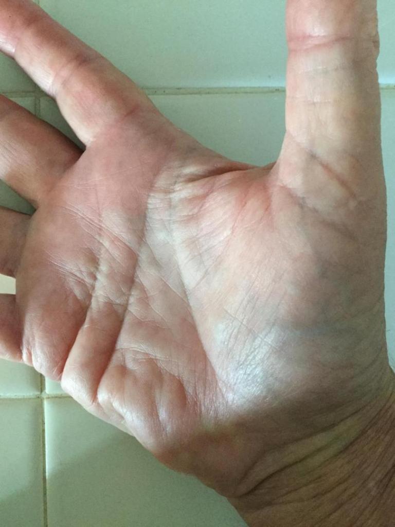 mypalm.thumb.JPG.06d2c8f6efc64dbf77e330cd6f2eede1.JPG